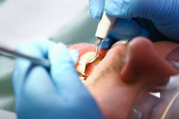 Best Emergency Treatment for Dental Infections or Abscesses in Lake Tansi, TN