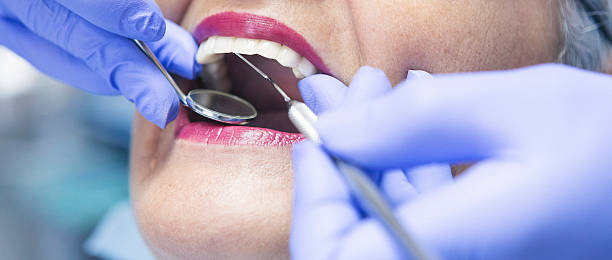 Best Emergency Wisdom Teeth Removal in Lake Tansi, TN